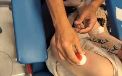 IBIMA participa en un proyecto europeo para evaluar una forma de realizar controles de sangre menos invasiva en pacientes con cáncer colorrectal