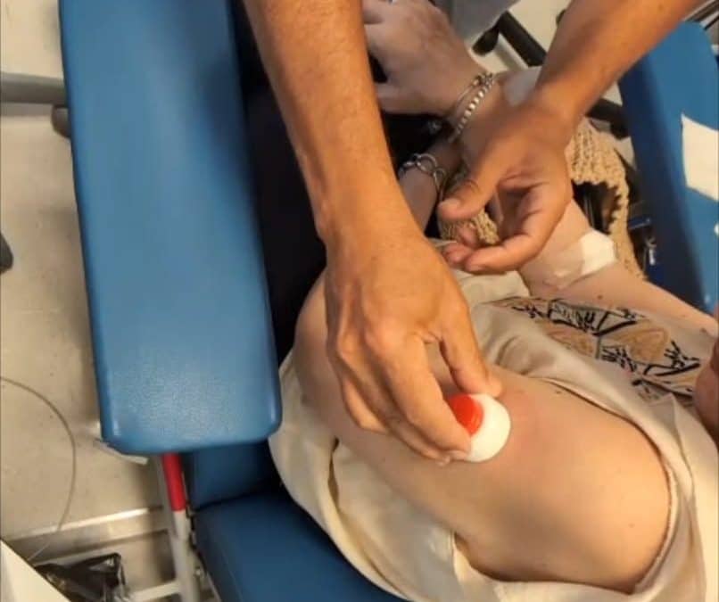 IBIMA participa en un proyecto europeo para evaluar una forma de realizar controles de sangre menos invasiva en pacientes con cáncer colorrectal